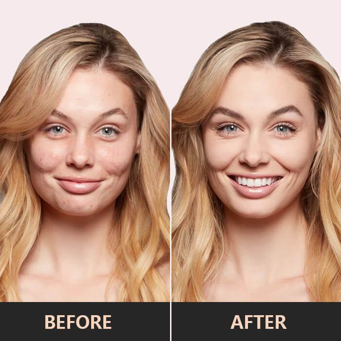 Flysmus™ — Flawless All-Day Coverage You Trust | 50% Off