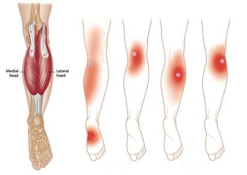 Self-heating knee band: fast pain relief