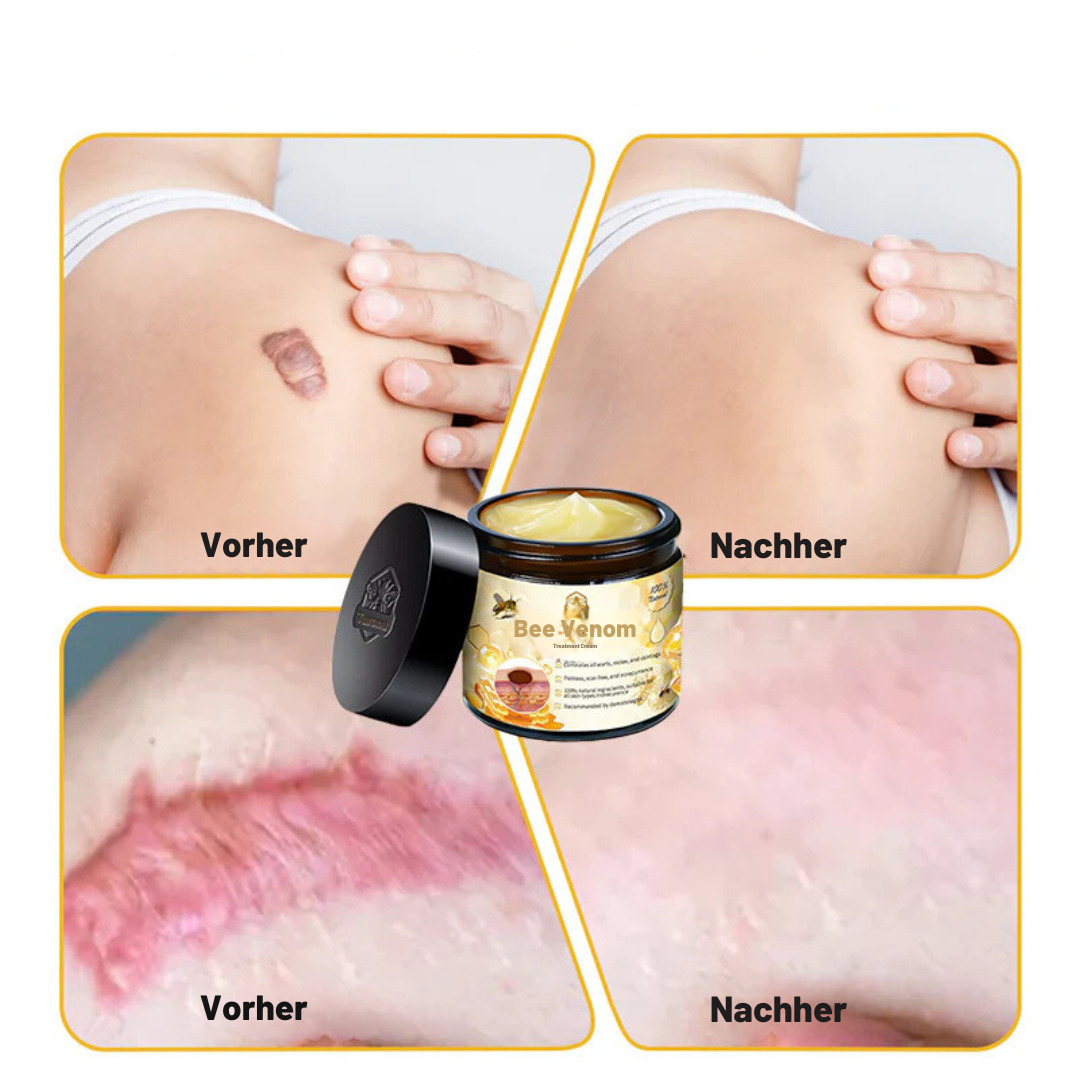 Beelixir™ Bee Venom Skin Treatment Cream
