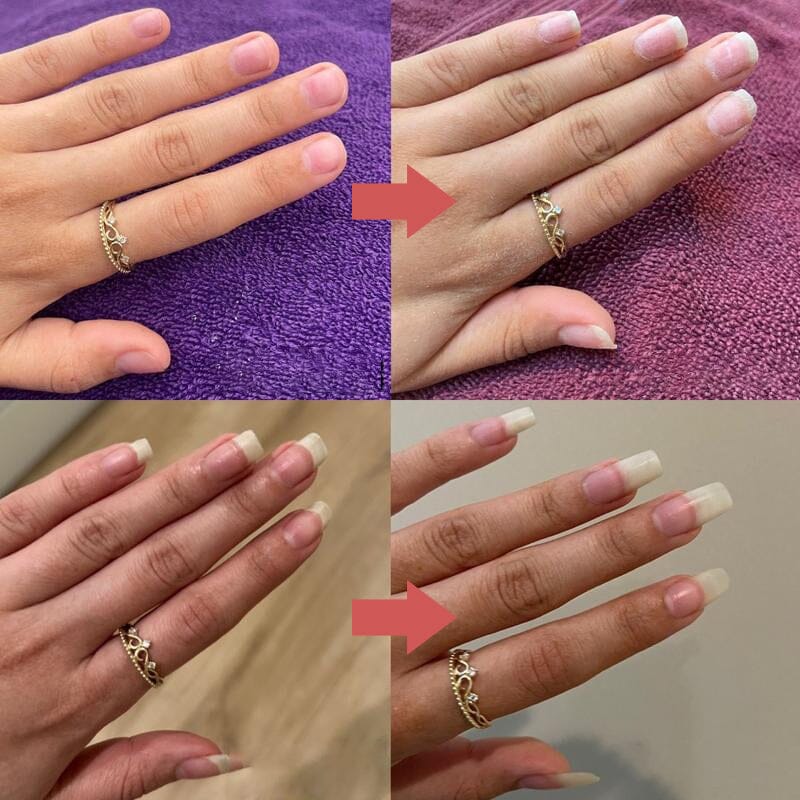 1+1 FREE | Nailixir Discover The Secret Of Healthy Nails!
