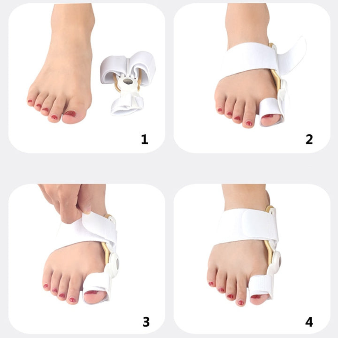 Articulated Orthopedic Bunions Corrector - BUY 1 GET 1 FREE