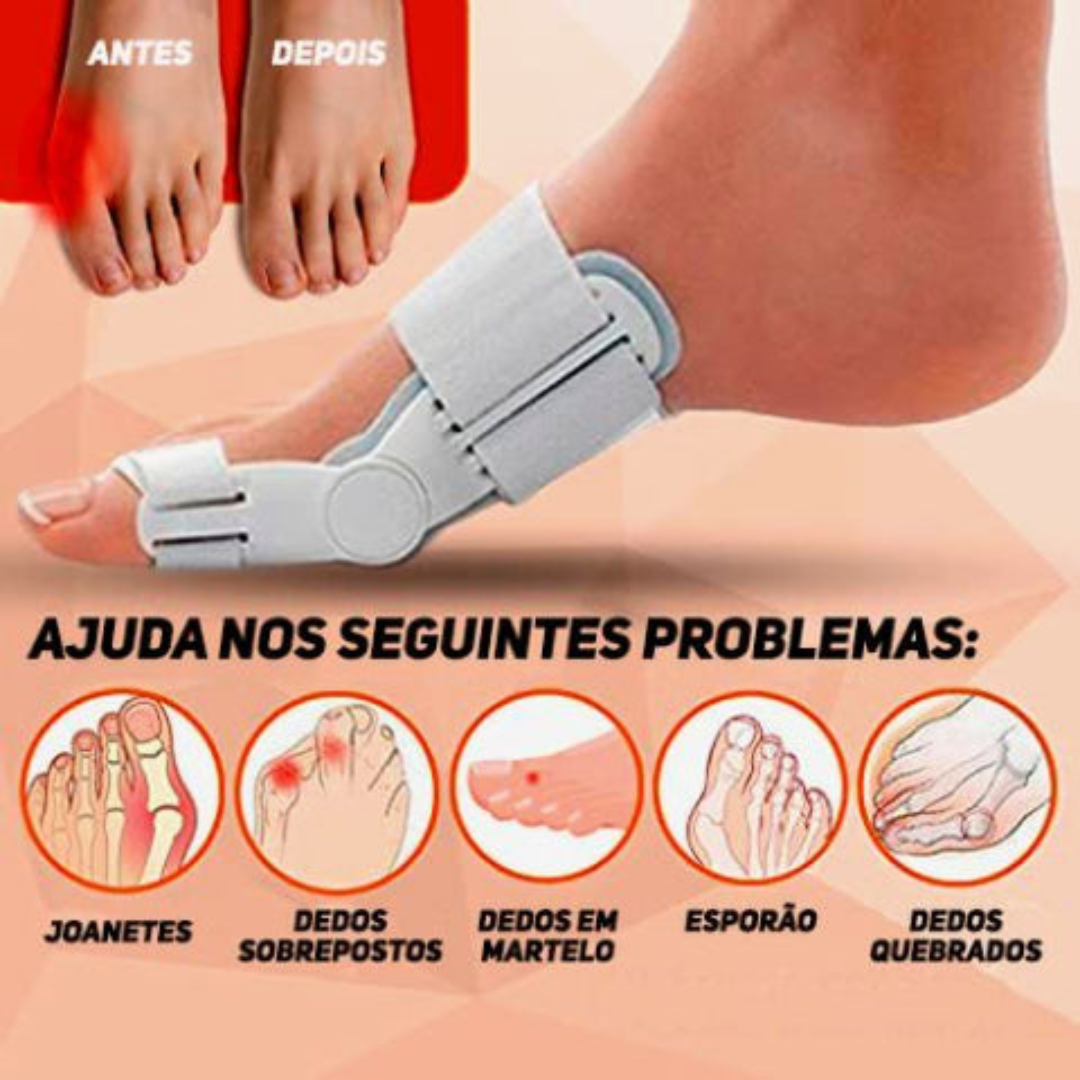 Articulated Orthopedic Bunions Corrector - BUY 1 GET 1 FREE