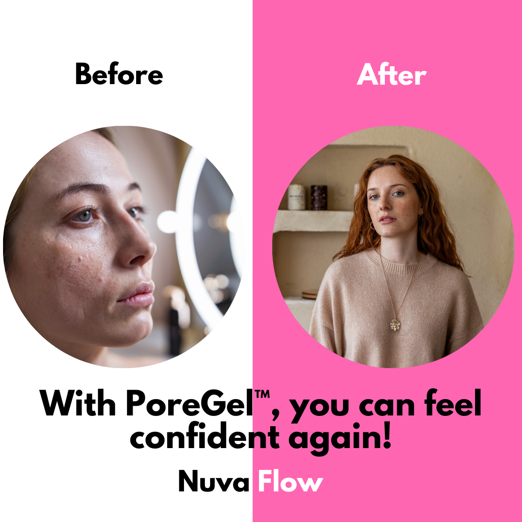 1+1 FREE | PoreGel - Be confident in your own skin again!