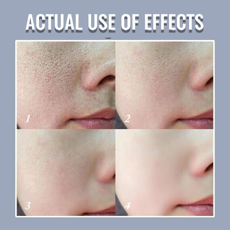 100% Natural & 2025 Pore Invisible Cream | 1+1 FREE