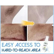 1+1 FREE | SilkAway Spray For Semi-permanent Hair Removal