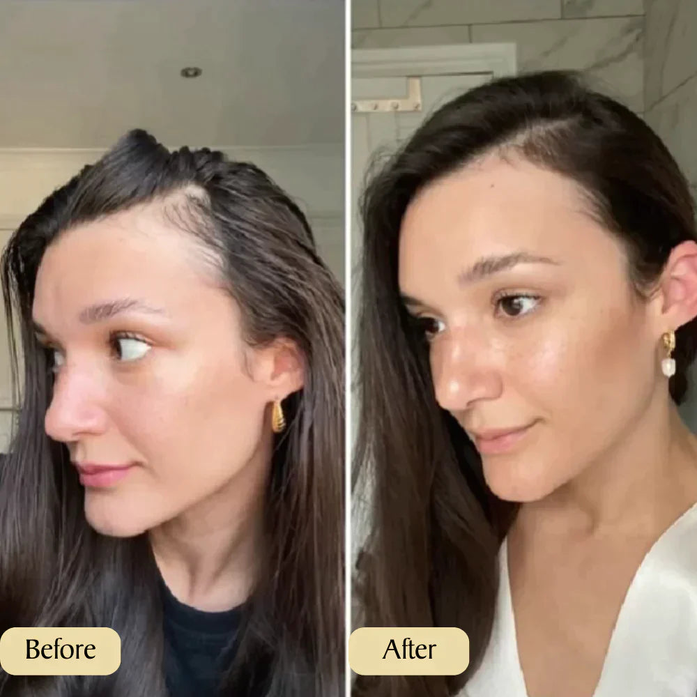 1+1 FREE | Carvenchy™ Your natural oil treatment for hair growth