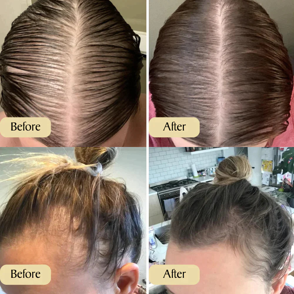 1+1 FREE | Carvenchy™ Your natural oil treatment for hair growth