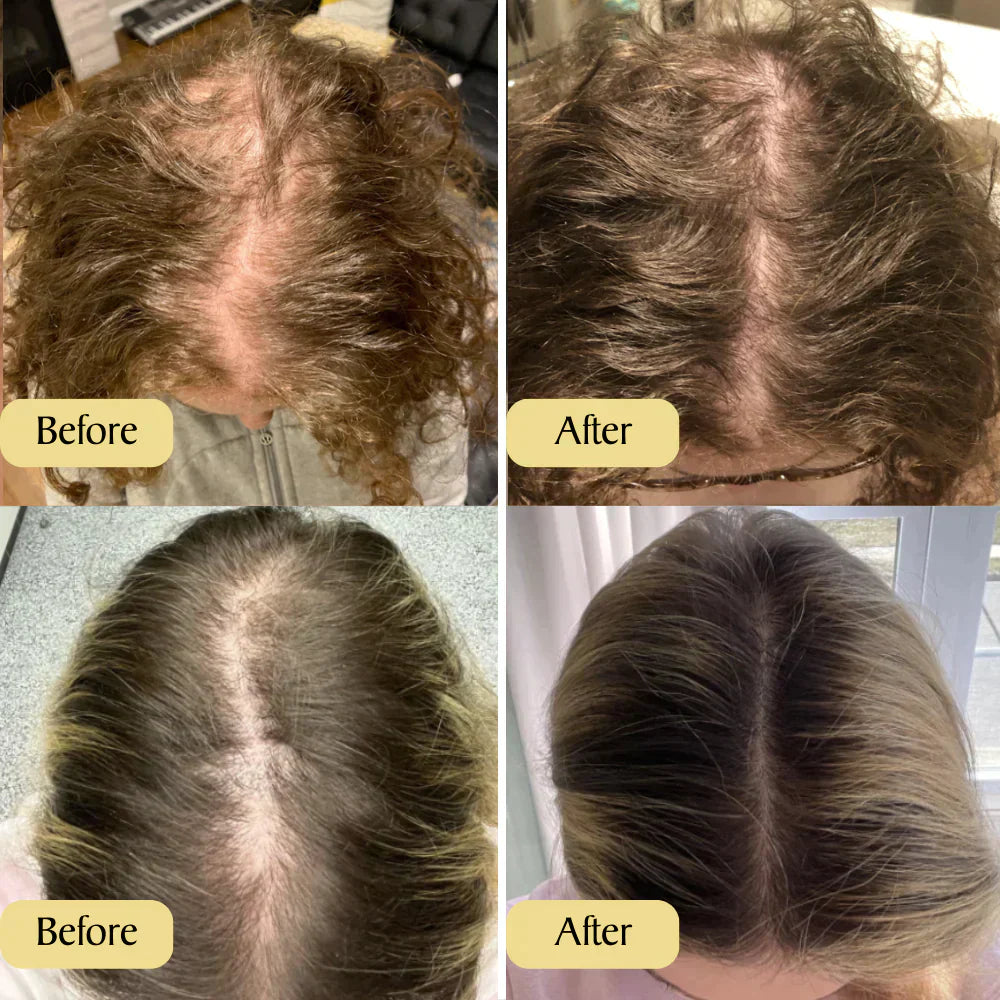1+1 FREE | Carvenchy™ Your natural oil treatment for hair growth