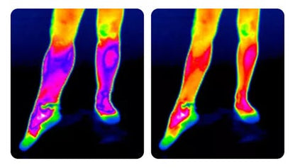 Self-heating knee band: fast pain relief