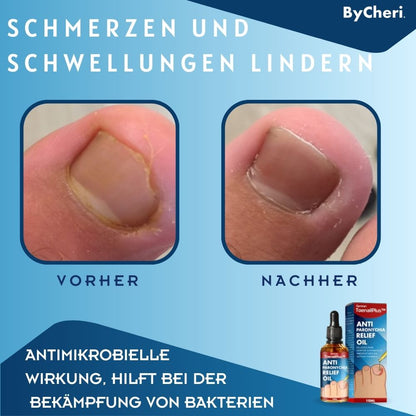 ToePerfect™ - Heals Toe and Finger Nails | Buy 1 Get 1 FREE TEMPORARILY
