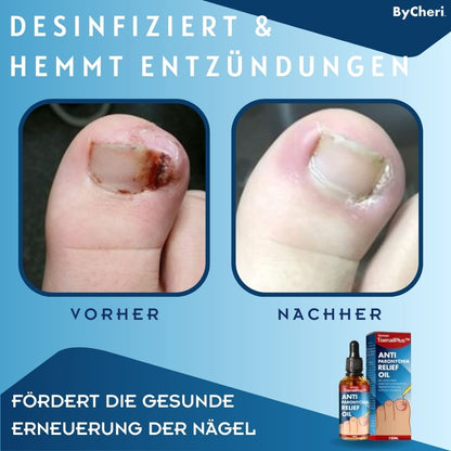 ToePerfect™ - Heals Toe and Finger Nails | Buy 1 Get 1 FREE TEMPORARILY