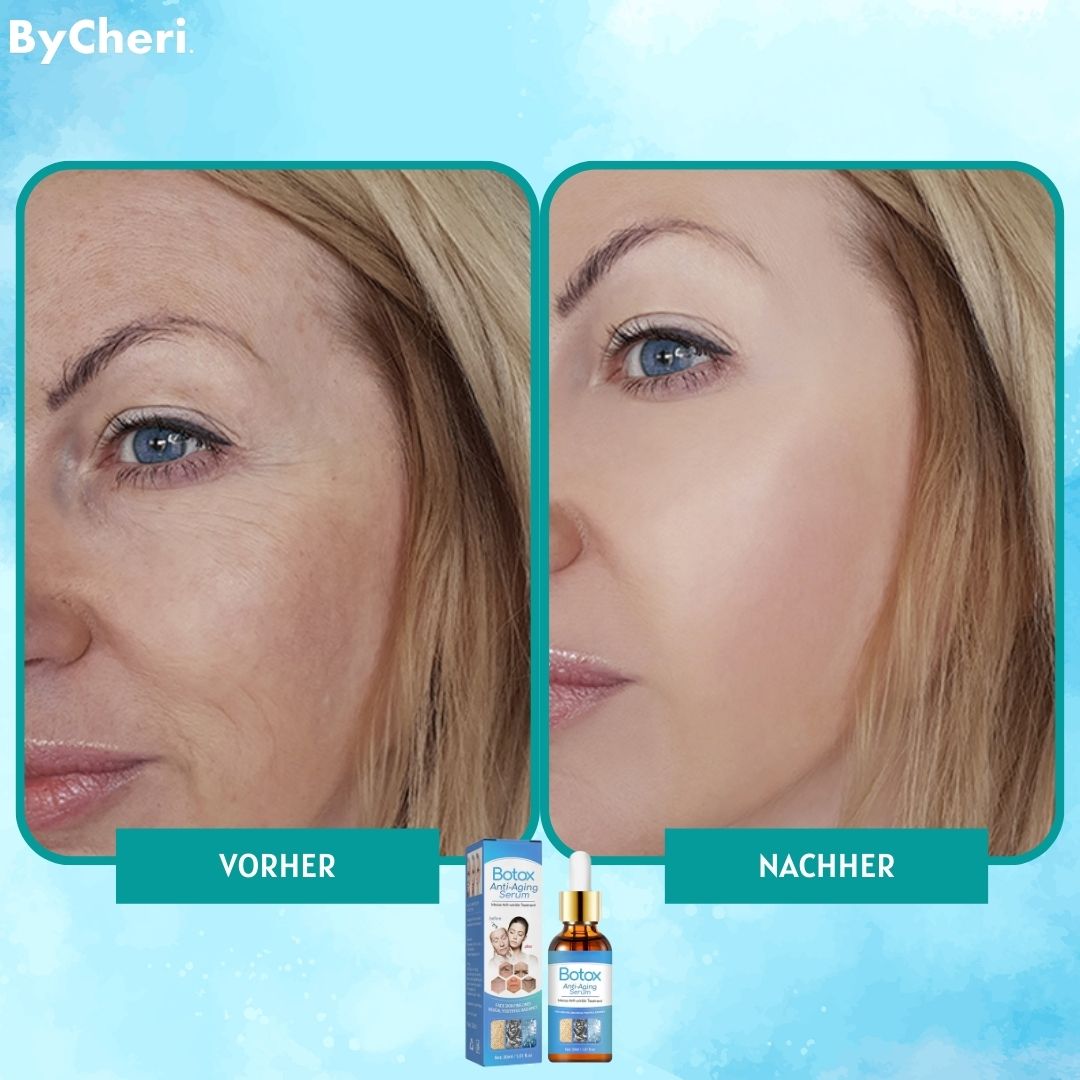 LAST DAY 1+1 FREE | YouthGlow™ | Botox Anti-Aging Serum