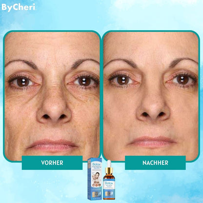 LAST DAY 1+1 FREE | YouthGlow™ | Botox Anti-Aging Serum