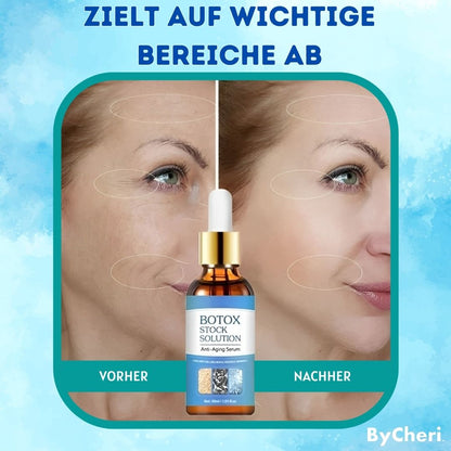 LAST DAY 1+1 FREE | YouthGlow™ | Botox Anti-Aging Serum