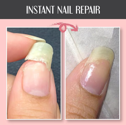 Repairing and Protective Nail Gel: Strengthens and Regenerates | 1+1 Free
