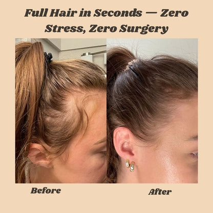 Hair Fiber Spray | Instant Fullness | Sweat & Weather Resistant | Multiple Colors