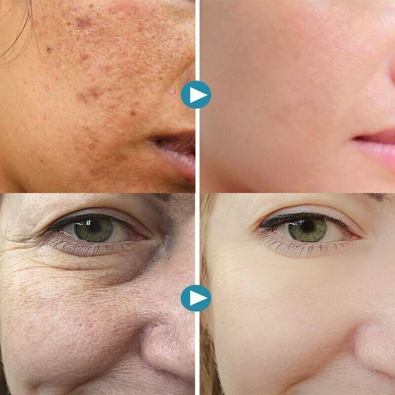 100% Natural & 2025 Pore Invisible Cream | 1+1 FREE