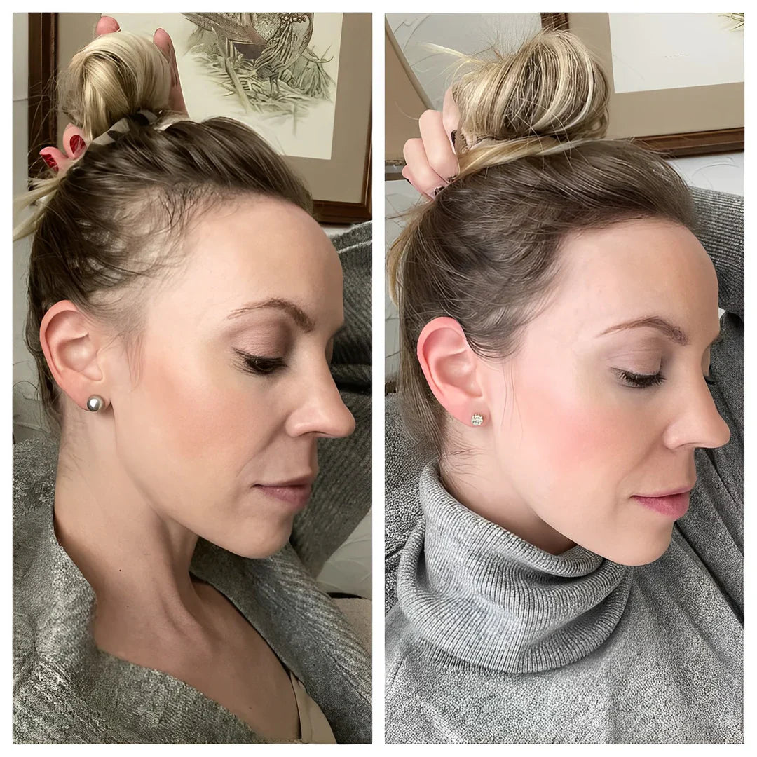 RiceGlow™ — Thicker Hair, Unshakable Confidence | 1+1 Free