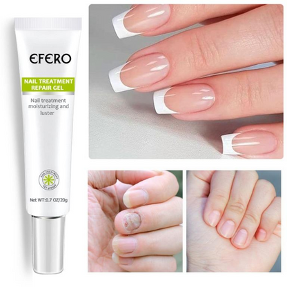 Efero MyCare Gel for nail care