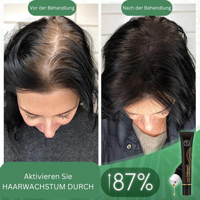 HairBoost Bio Hair Serum Roller (Buy 1 Get 1 Free)