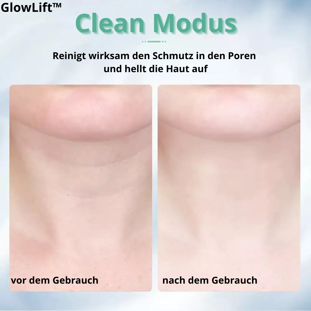 GlowLift™ - Anti-Wrinkle, Face, and Neck Massager