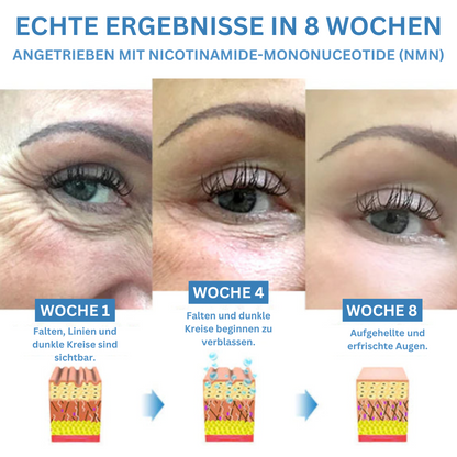 HYAKUON™ - Eye bags remover and firming cream (1+1 FREE)