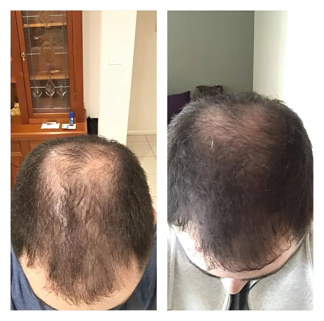 RiceGlow™ — Thicker Hair, Unshakable Confidence | 1+1 Free