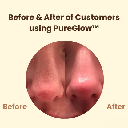 Last Day 50% OFF🔥 | PureGlow™ Black Tea Mask