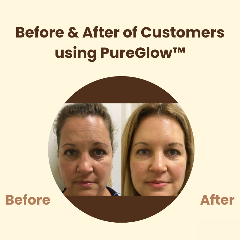Last Day 50% OFF🔥 | PureGlow™ Black Tea Mask
