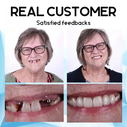 SmilePro – High-quality, Individually Fitted Silicone Denture Set