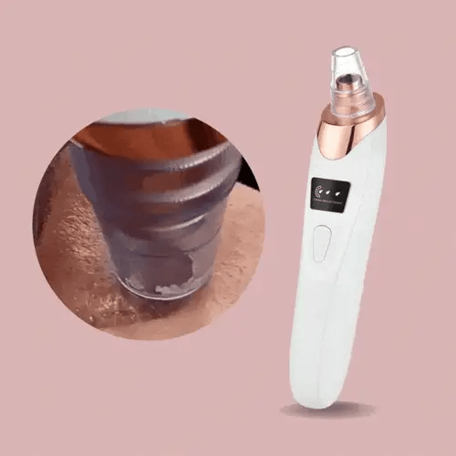 PoreGlow Blackhead Remover