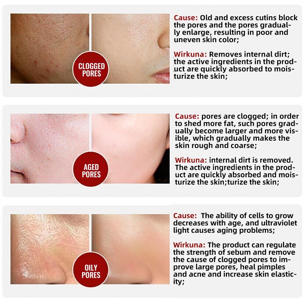 100% Natural & 2025 Pore Invisible Cream | 1+1 FREE