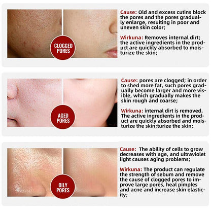 100% Natural & 2025 Pore Invisible Cream | 1+1 FREE