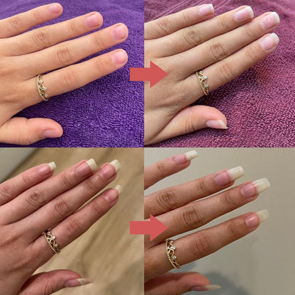 HealthyNail | Nail Nourishing Growth Oil (1+1 FREE)