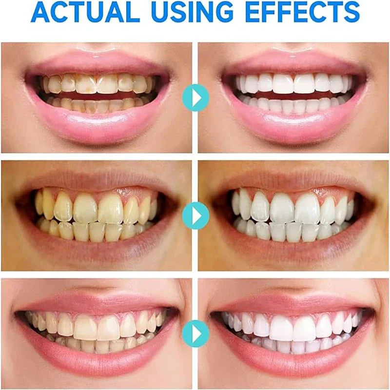 PureTeeth Niacinamide Whitening Toothpaste