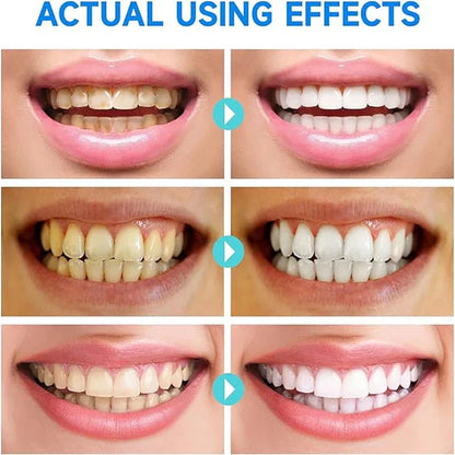 PureTeeth Niacinamide Whitening Toothpaste